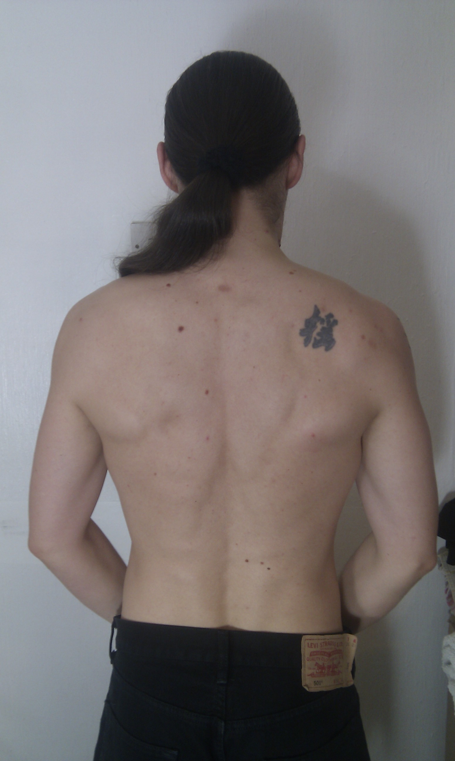 Back, tensed