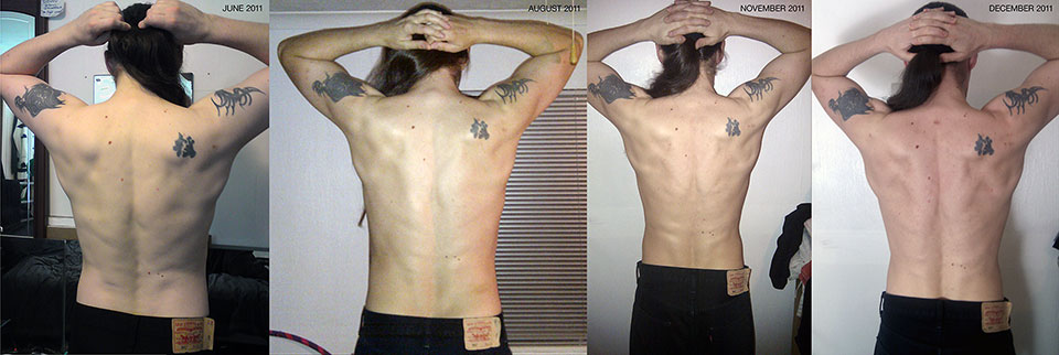 Montage of tensed back photos.