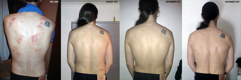 Montage of relaxed back photos.